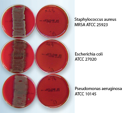 bacteria-antimicrobial-cables